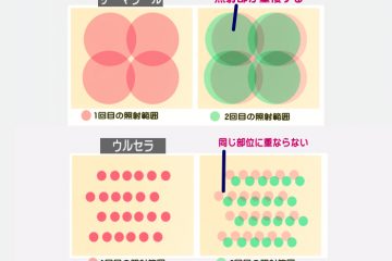 次の治療はいつがベストか？ウルセラとサーマクールの違い２